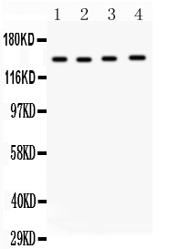 Anti-MMP14 antibody, PA2147, Western blotting All lanes: Anti MMP14 (PA2147) at 0.5ug/ml Lane 1: Rat Spleen Tissue Lysate at 50ug Lane 2: Human Placenta Tissue Lysate at 50ug Lane 3: HELA Whole Cell Lysate at 40ug Lane 4: A549 Whole Cell Lysate at 40ug Predicted bind size: 66KD Observed bind size: 150KD