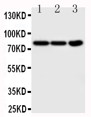 Anti-TrkA antibody, PA2149-1, Western blotting Lane 1: COLO320 Cell Lysate Lane 2: HT1080 Cell Lysate Lane 3: U87 Cell Lysate