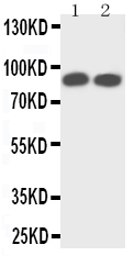 Anti-TrkA antibody, PA2149-2, Western blotting Lane 1: Rat Brain Tissue Lysate Lane 2: Mouse Brain Tissue Lysate