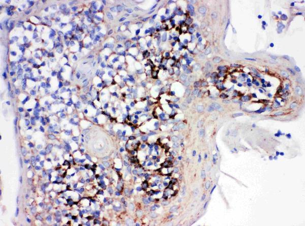 IHC analysis of Cyclophilin B/PPIB using anti-Cyclophilin B/PPIB antibody (PA2151). Cyclophilin B/PPIB was detected in paraffin-embedded section of human tonsil tissues. Heat mediated antigen retrieval was performed in citrate buffer (pH6, epitope retrieval solution) for 20 mins. The tissue section was blocked with 10% goat serum. The tissue section was then incubated with 1μg/ml rabbit anti-Cyclophilin B/PPIB Antibody (PA2151) overnight at 4°C. Biotinylated goat anti-rabbit IgG was used as secondary antibody and incubated for 30 minutes at 37°C. The tissue section was developed using Strepavidin-Biotin-Complex (SABC)(Catalog # SA1022) with DAB as the chromogen.