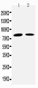 Anti-TGM2 antibody, PA2153, Western blotting Lane 1: JURKAT Cell Lysate Lane 2: HELA Cell Lysate