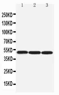 Anti-beta Arrestin 1 antibody, PA2155, Western blotting Lane 1: Rat Lung Tissue Lysate Lane 2: Rat Skeletal Muscle Tissue Lysate Lane 3: SW620 Cell Lysate