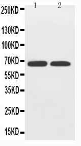 Anti-GLUT12 antibody, PA2167, Western blotting Lane 1: PC-12 Cell Lysate Lane 2: A549 Cell Lysate