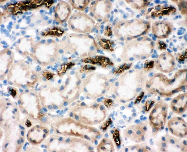 Anti-SLC12A1 antibody, PA2168, IHC(F) IHC(F): Rat Kidney Tissue