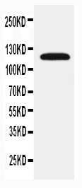 Anti-SLC12A1 antibody, PA2168, Western blotting WB: Rat Kidney Tissue Lysate