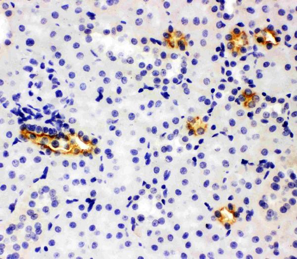 Anti-SLC12A1 antibody, PA2168, IHC(P) IHC(P): Rat Kidney Tissue