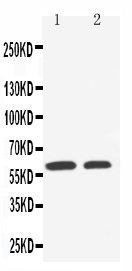 Anti-SLC22A1 antibody, PA2172, Western blotting Lane 1: HELA Cell Lysate Lane 2: A549 Cell Lysate