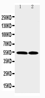 Anti-CCR3 antibody, PA2176, Western blotting Lane 1: K562 Cell Lysate Lane 2: RAJI Cell Lysate