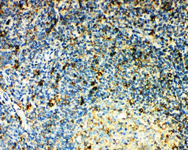 Anti-CCR3 antibody, PA2176, IHC(P) IHC(P): Human Tonsil Tissue