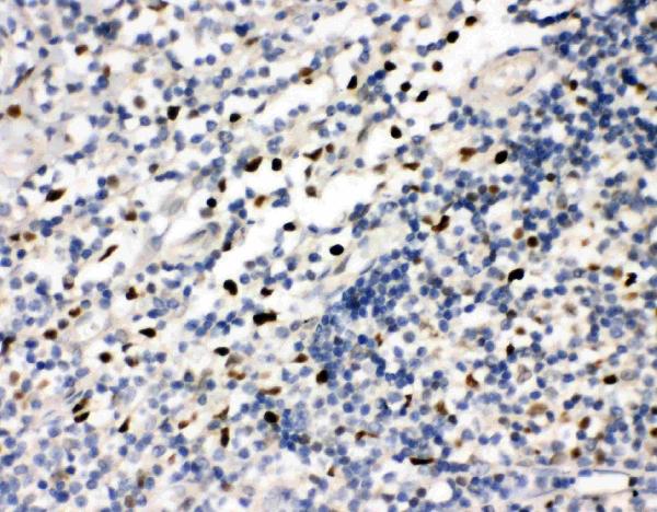 Anti-FLI1 antibody, PA2179, IHC(P) IHC(P): Human Tonsil Tissue