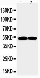 Anti-FLI1 antibody, PA2179, Western blotting Lane 1: JURKAT Cell Lysate Lane 2: RAJI Cell Lysate