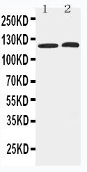 Anti-HDAC5 antibody, PA2180, Western blotting Lane 1: HELA Cell Lysate Lane 2: COLO320 Cell Lysate