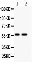 Anti-PIAS4 antibody, PA2215, Western blotting All lanes: Anti PIAS4 (PA2215) at 0.5ug/ml Lane 1: Human Placenta Tissue Lysate at 50ug Lane 2: A431 Whole Cell Lysate at 40ug Predicted bind size: 57KD Observed bind size: 57KD