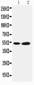 Anti-SBP/SELENBP1 antibody, PA2216, Western blotting Lane 1: COLO320 Cell Lysate Lane 2: PANC Cell Lysate