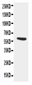 Anti-AACT/SERPINA3 antibody, PA2217, Western blotting WB: SMMC Cell Lysate