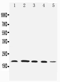 Anti-Diubiquitin antibody, PA2222, Western blotting Lane 1: HELA Cell Lysate Lane 2: SKOV Cell Lysate Lane 3: MCF-7 Cell Lysate Lane 4: A549 Cell Lysate Lane 5: SMMC Cell Lysate