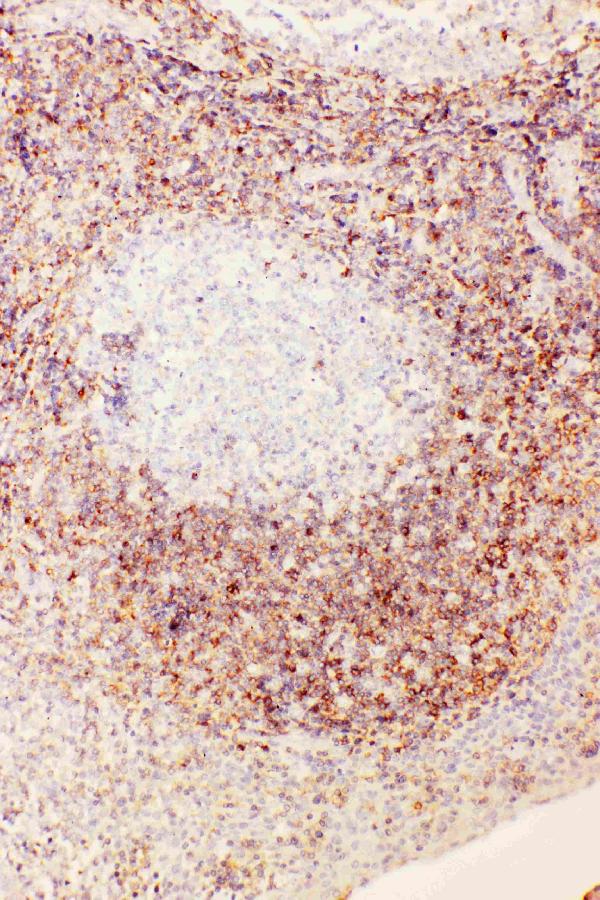 Anti-Diubiquitin antibody, PA2222, IHC(P) IHC(P): Human Tonsil Tissue