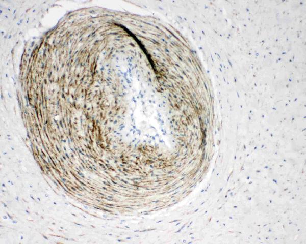 Anti-Calponin antibody, PA2224, IHC(P) IHC(P): Human Placenta Tissue