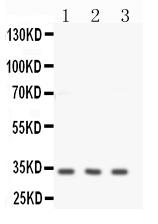 Anti-Calponin antibody, PA2224,Western blotting All lanes: Anti -Calponin (PA2224) at 0.5ug/ml Lane 1: HELA Whole Cell Lysate at 40ug Lane 2: JURKAT Whole Cell Lysate at 40ug Lane 3: MCF-7 Whole Cell Lysate at 40ug Predicted bind size: 33KD Observed bind size: 33KD