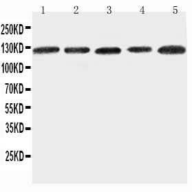 Anti-ITGA7 antibody, PA2226, Western blotting Lane 1: 293T Cell Lysate Lane 2: A431 Cell Lysate Lane 3: HELA Cell Lysate Lane 4: JURKAT Cell Lysate Lane 5: RAJI Cell Lysate