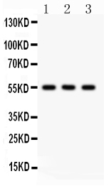 Anti-PLTP antibody, PA2228,Western blotting All lanes: Anti PLTP (PA2228) at 0.5ug/ml Lane 1: MCF-7 Whole Cell Lysate at 40ug Lane 2: RAJI Whole Cell Lysate at 40ug Lane 3: HELA Whole Cell Lysate at 40ug Predicted bind size: 55KD Observed bind size: 55KD