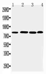 Anti-PROX1 antibody, PA2229, Western blotting Lane 1: Rat Thymus Tissue Lysate Lane 2: HELA Cell Lysate Lane 3: JURKAT Cell Lysate Lane 4: MM231 Cell Lysate