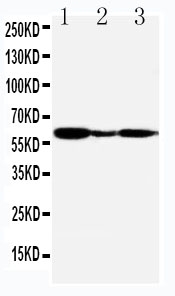 Anti-G-protein coupled receptor 30 antibody, PA2235, Western blotting Lane 1: COLO320 Cell Lysate Lane 2: MCF-7 Cell Lysate Lane 3: COS7 Cell Lysate