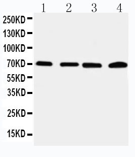 Anti-IRAK2 antibody, PA2236, Western blotting Lane 1: 22RV Cell Lysate Lane 2: A549 Cell Lysate Lane 3: PANC Cell Lysate Lane 4: SMMC Cell Lysate