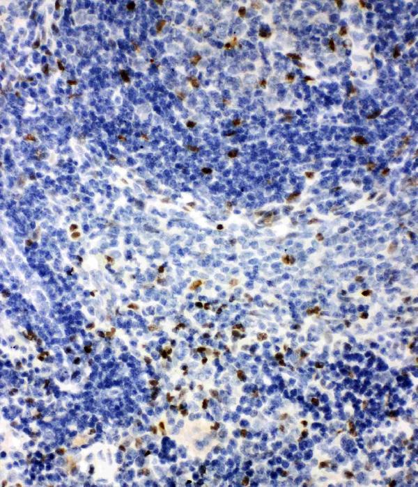 Anti-IRAK2 antibody, PA2236, IHC(P) IHC(P): Rat Spleen Tissue