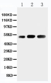 Anti-KIN antibody, PA2238, Western blotting Lane 1: Rat Skeletal Muscle Tissue Lysate Lane 2: Human Placenta Tissue Lysate Lane 3: Rat Testis Tissue Lysate