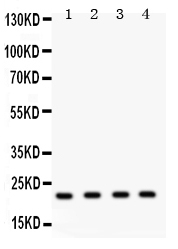 Anti-Securin antibody, PA2240, Western blotting All lanes: Anti PTTG1 (PA2240) at 0.5ug/ml Lane 1: HELA Whole Cell Lysate at 40ug Lane 2: MCF-7 Whole Cell Lysate at 40ug Lane 3: SKOV Whole Cell Lysate at 40ug Lane 4: A375 Whole Cell Lysate at 40ug Predicted bind size: 22KD Observed bind size: 22KD