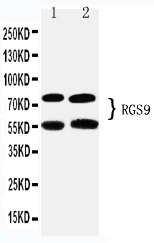 Anti-RGS9 antibody, PA2241, Western blotting Lane 1: Rat Brain Tissue Lysate Lane 2: Mouse Brain Tissue Lysate