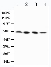 Anti-RIP3 antibody, PA2242, Western blotting Lane 1: PANC Cell Lysate Lane 2: SW620 Cell Lysate Lane 3: SKOV-3 Cell Lysate Lane 4: M231 Cell Lysate