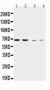 Anti-CAT1 antibody, PA2245, Western blotting Lane 1: Human Placenta Tissue Lysate Lane 2: HELA Cell Lysate Lane 3: SKOV-3 Cell Lysate Lane 4: HT1080 Cell Lysate