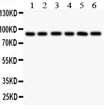 Anti-TLR1 antibody, PA2246, Western blotting All lanes: Anti TLR1 (PA2246) at 0.5ug/ml Lane 1: COLO320 Whole Cell Lysate at 40ug Lane 2: SW620 Whole Cell Lysate at 40ug Lane 3: SKOV Whole Cell Lysate at 40ug Lane 4: JURKAT Whole Cell Lysate at 40ug Lane 5: CEM Whole Cell Lysate at 40ug Lane 6: PANC Whole Cell Lysate at 40ug Predicted bind size: 90KD Observed bind size: 90KD