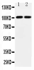 Anti-GRIA3 antibody, PA2249, All Western blotting All lanes: Anti-GRIA3 (PA2249) at 0.5ug/ml