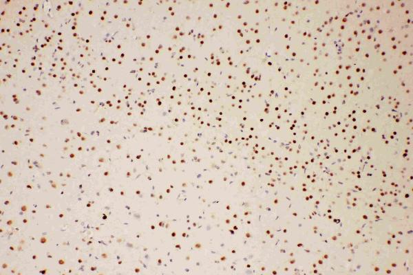 Anti-PIAS1 antibody, PA2252, IHC(P) IHC(P): Rat Brain Tissue