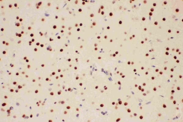 Anti-PIAS1 antibody, PA2252, IHC(P) IHC(P): Rat Brain Tissue