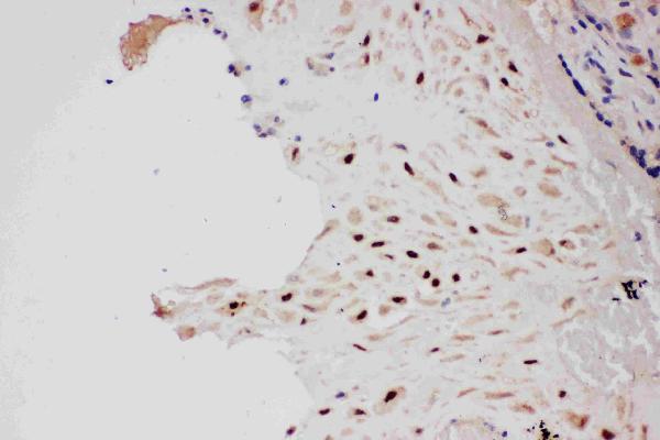 Anti-PIAS1 antibody, PA2252, IHC(P) IHC(P): Human Placenta Tissue