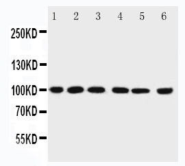 Anti-PIAS1 antibody, PA2252, All Western blotting All lanes: Anti-PIAS1(PA2252) at 0.5ug/ml