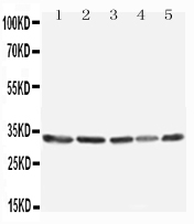 Anti-TNFAIP8L3 antibody, PA2257, All Western blotting All lanes: Anti-TNFAIP8L3(PA2257) at 0.5ug/ml