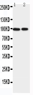 Anti-EPB41L1 antibody, PA2266, All Western blotting All lanes: Anti-EPB41L1(PA2266) at 0.5ug/ml