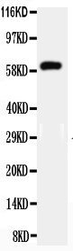 Anti-HNF1 beta antibody, PA2267, All Western blotting All lanes: Anti-HNF1B(PA2267) at 0.5ug/ml