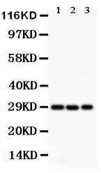 Anti-CSEN antibody, PA2272, Western blotting All lanes: Anti CSEN (PA2272) at 0.5ug/ml Lane 1: HELA Whole Cell Lysate at 40ug Lane 2: U87 Whole Cell Lysate at 40ug Lane 3: SHG Whole Cell Lysate at 40ug Predicted bind size: 29KD Observed bind size: 29KD