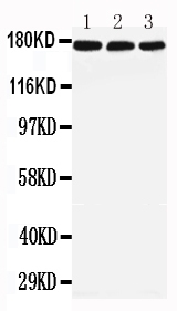 Anti-LRP5 antibody, PA2273, All Western blotting All lanes: Anti-LRP5(PA2273) at 0.5ug/ml