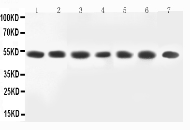 Anti-MEK2 antibody, PA2274, All Western blotting All lanes: MAP2K2(PA2274) at 0.5ug/ml