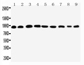 Anti-Plakophilin 2 antibody, PA2278, All Western blotting All lanes: Anti-PKP2(PA2278) at 0.5ug/ml