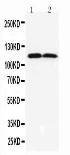 Anti-TMEM16A antibody, PA2290, All Western blotting All lanes: Anti-ANO1(PA2290) at 0.5ug/ml