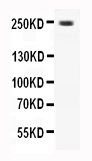 Anti-CaV1.3 antibody, PA2293, All Western blotting All lanes: Anti-CACNA1D(PA2293) at 0.5ug/ml