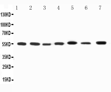 Anti-Kv1.1 potassium channel antibody, PA2296, All Western blotting All lanes: Anti-KCNA1(PA2296) at 0.5ug/ml